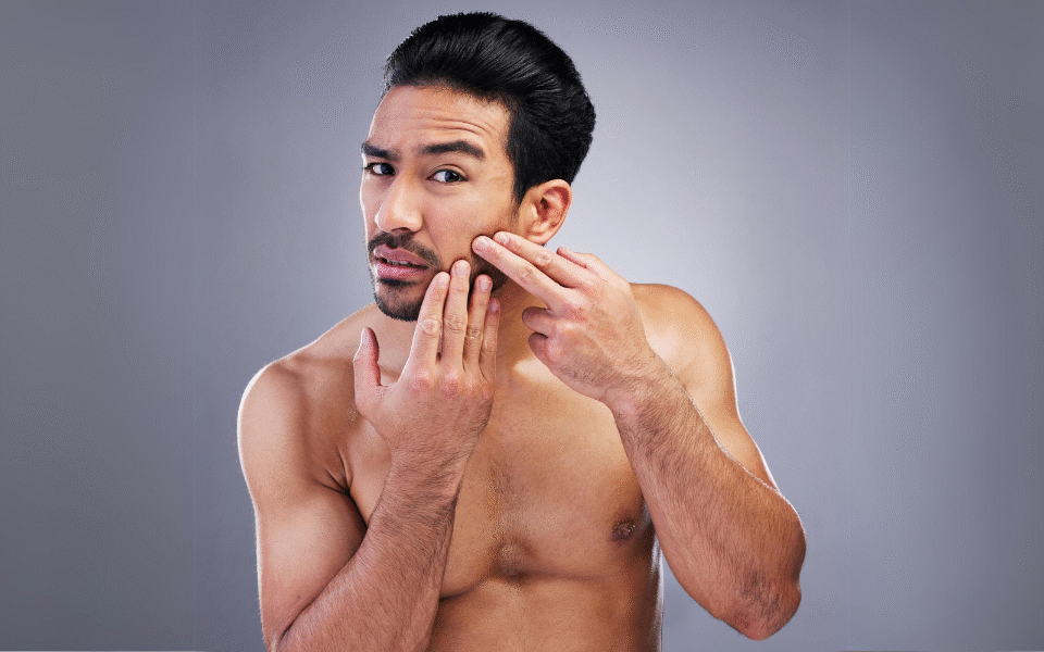 Get Clear Skin Naturally at Home