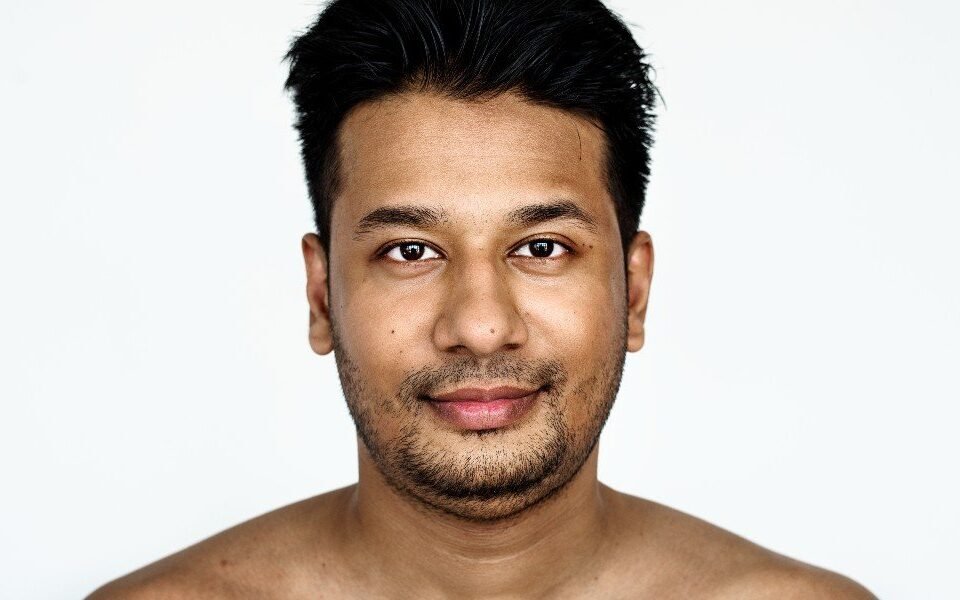 Uneven Skin Tone