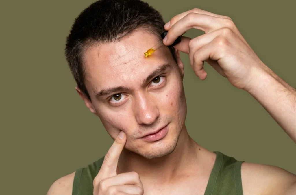 dark spots on face causes