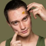 dark spots on face causes